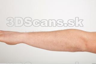 Photo reference of forearm 0001